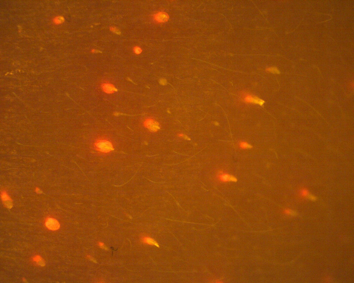 Liczba porfiryn po 28 dniach