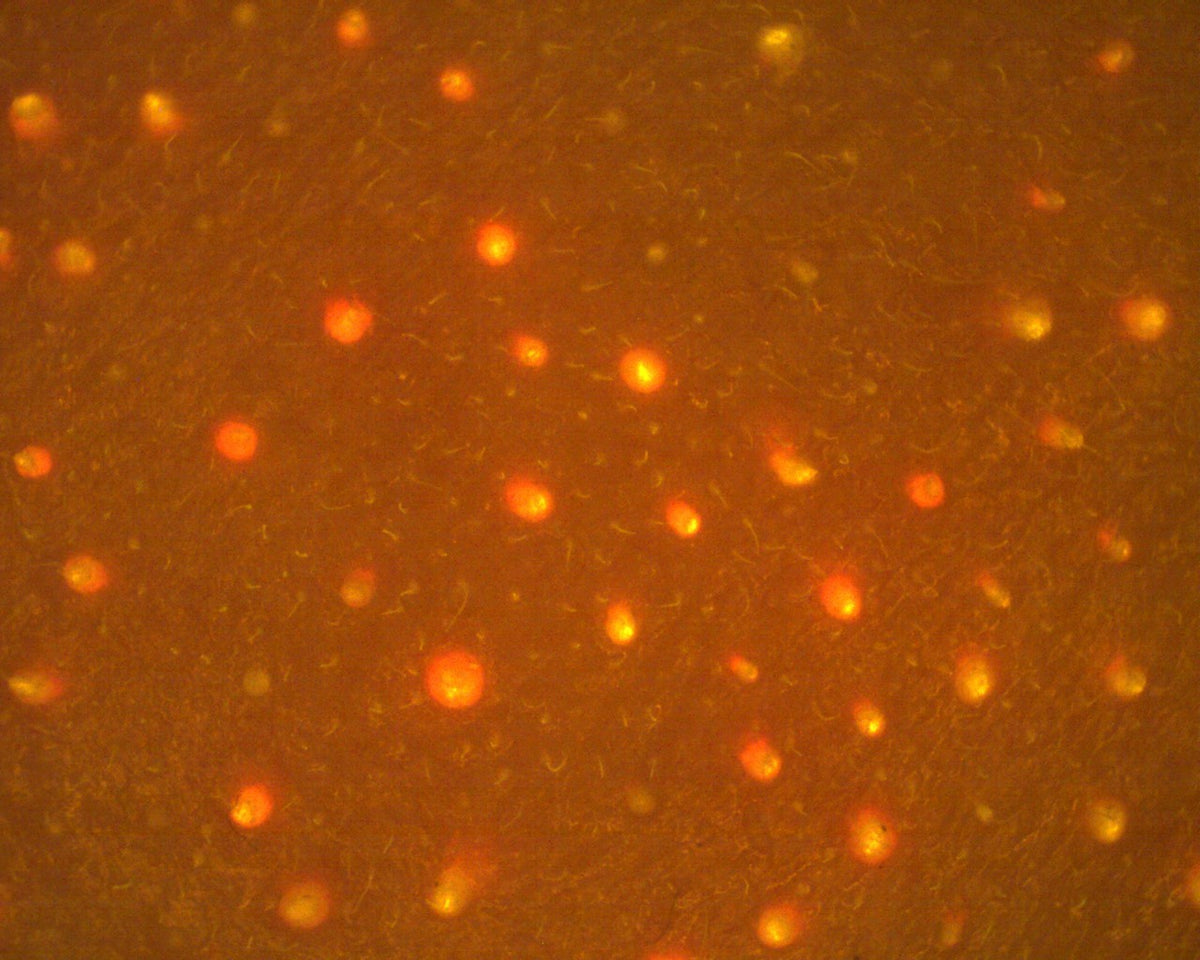 Liczba porfiryn przed