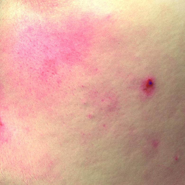 STAN ZACZERWIENIEŃ PRZED